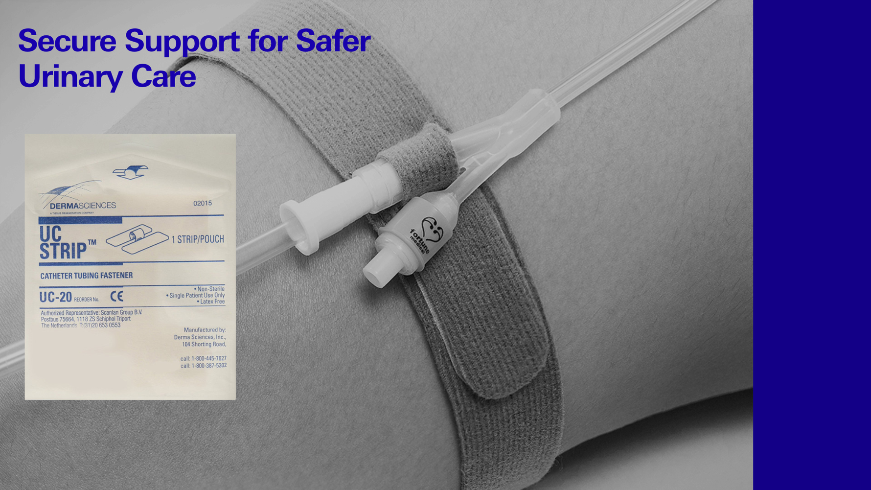 Catheter tubing fastener securing urinary catheter on leg, with UC Strip packaging visible