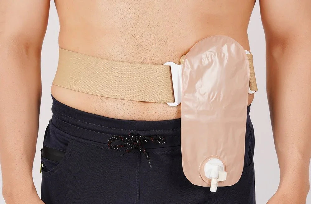 Ostomy bag with beige support belt worn on abdomen, medical home care supply
