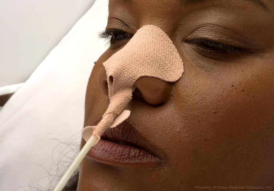 Dale NasoGastric Tube Holder Large/Adult 1 Piece | 160
