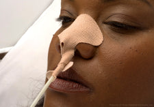 Dale NasoGastric Tube Holder Large/Adult 1 Piece | 160