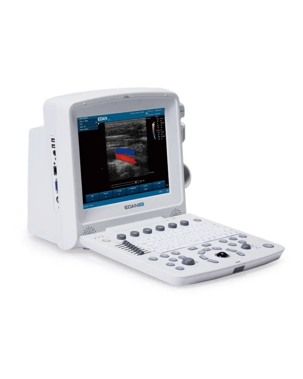 U50 Portable Ultrasound System | U50-PRIME