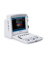 U50 Portable Ultrasound System | U50-PRIME
